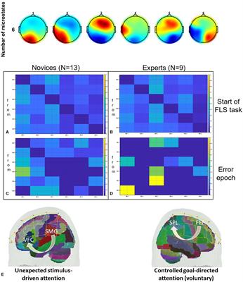 Brain-behavior analysis of transcranial direct current stimulation effects on a complex surgical motor task
